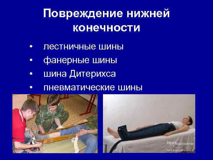Повреждение нижней конечности • • лестничные шины фанерные шины шина Дитерихса пневматические шины 