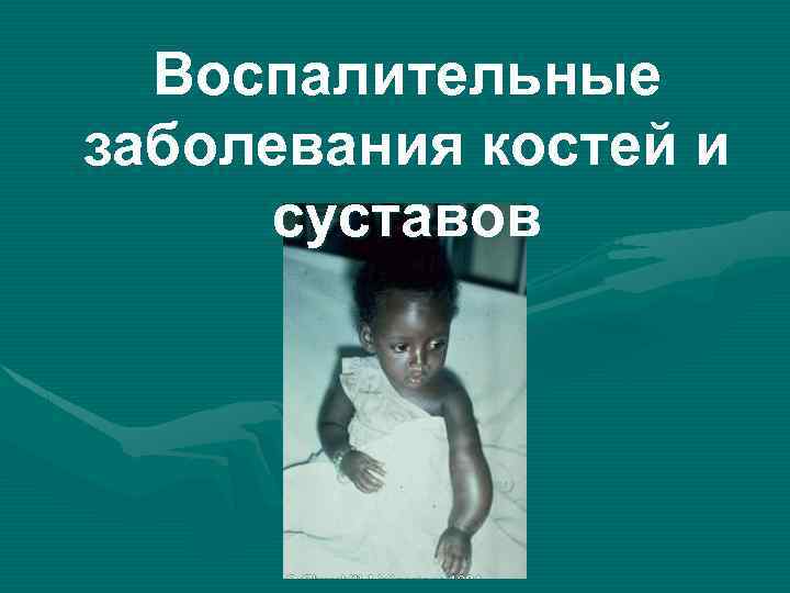 Воспалительные заболевания костей и суставов 