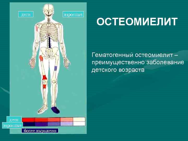 дети взрослые ОСТЕОМИЕЛИТ Гематогенный остеомиелит – преимущественно заболевание детского возраста дети взрослые более выражено