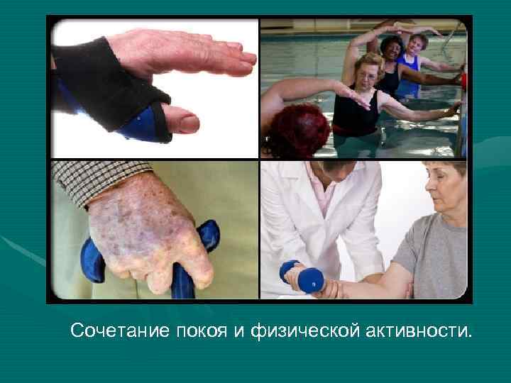 Сочетание покоя и физической активности. 