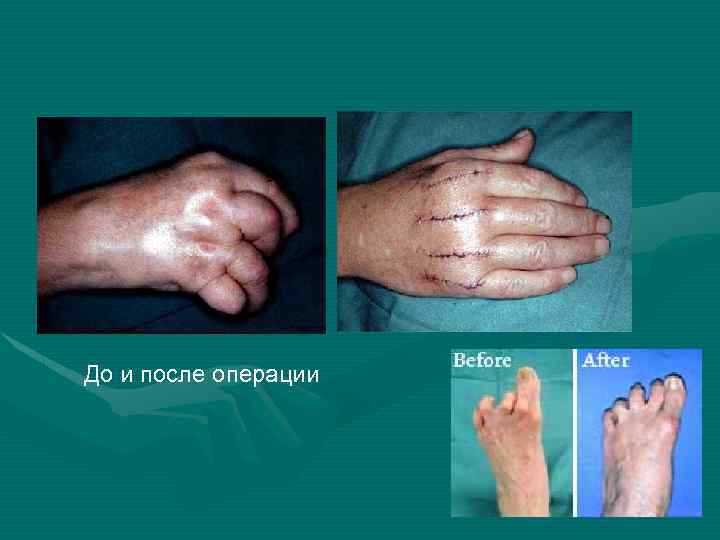 До и после операции 