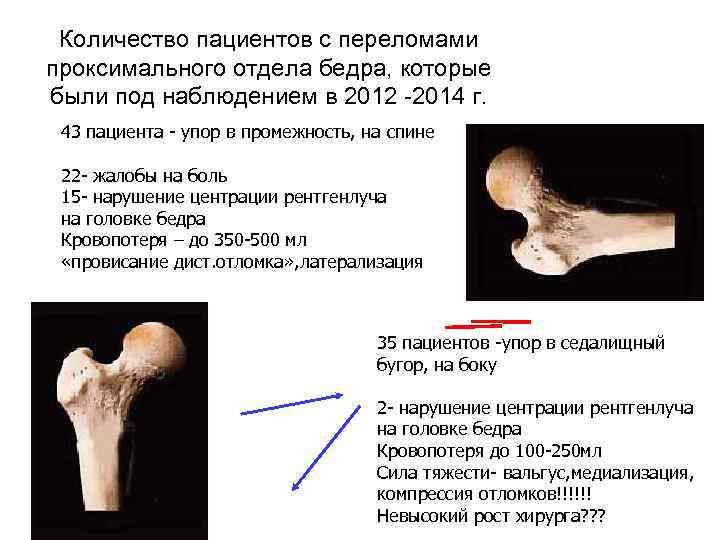 Количество пациентов с переломами проксимального отдела бедра, которые были под наблюдением в 2012 -2014