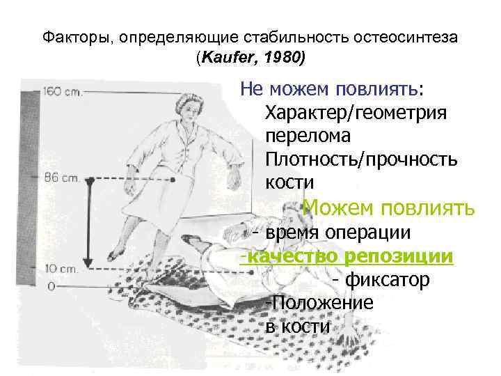 Факторы, определяющие стабильность остеосинтеза (Kaufer, 1980) Не можем повлиять: Характер/геометрия перелома Плотность/прочность кости Можем