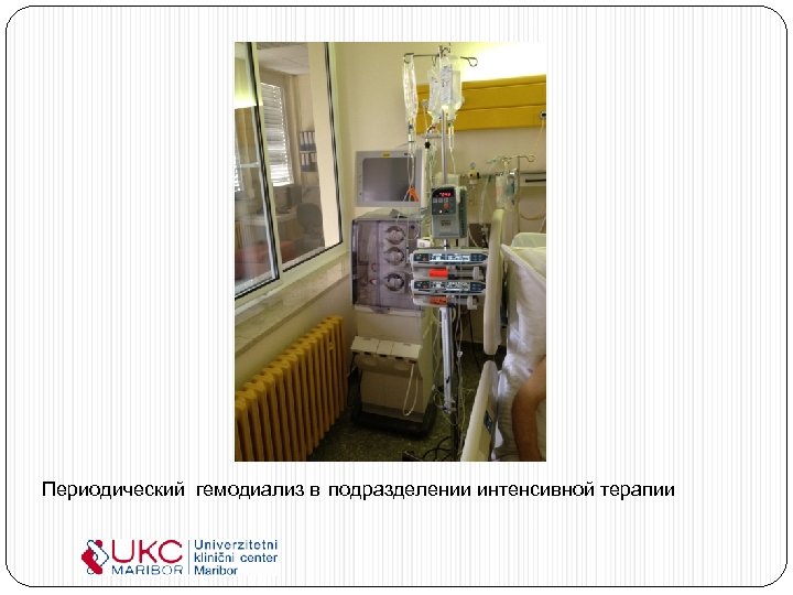 Периодический гемодиализ в подразделении интенсивной терапии 