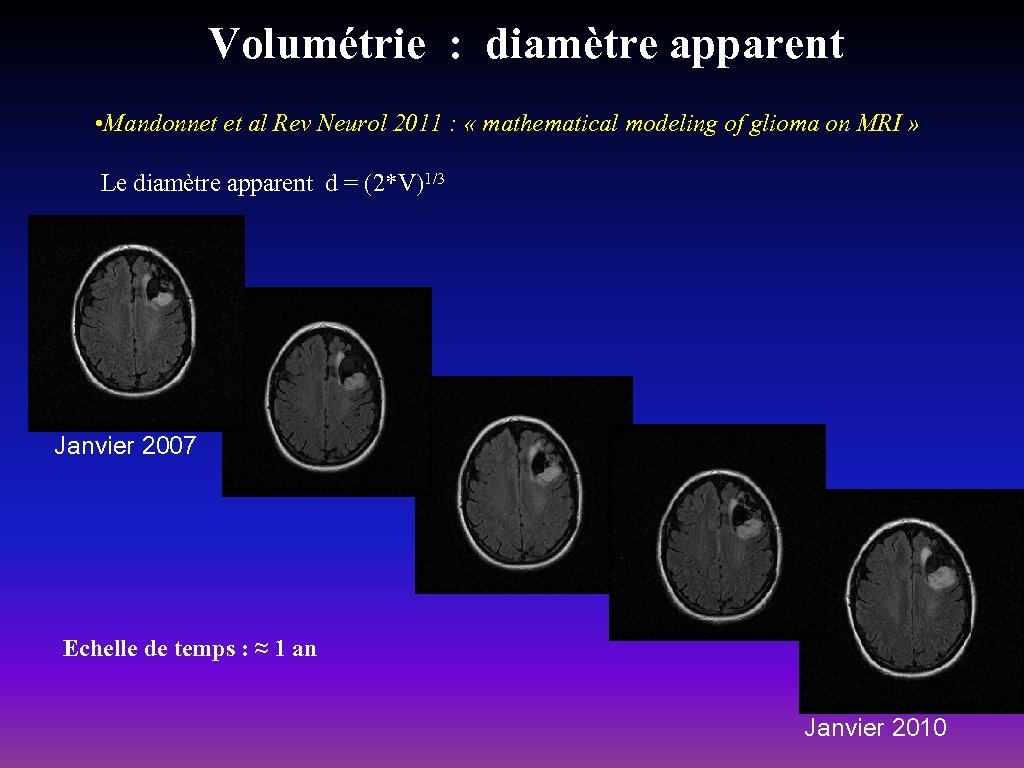 Volumétrie : diamètre apparent • Mandonnet et al Rev Neurol 2011 : « mathematical