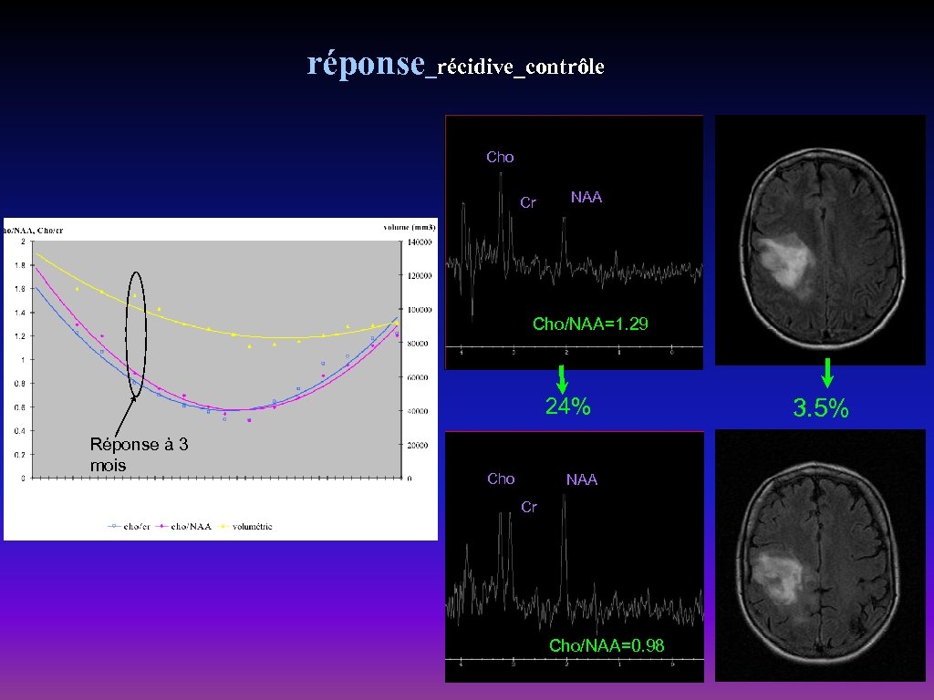 réponse_récidive_contrôle Cho Cr NAA Cho/NAA=1. 29 24% Réponse à 3 mois Cho NAA Cr