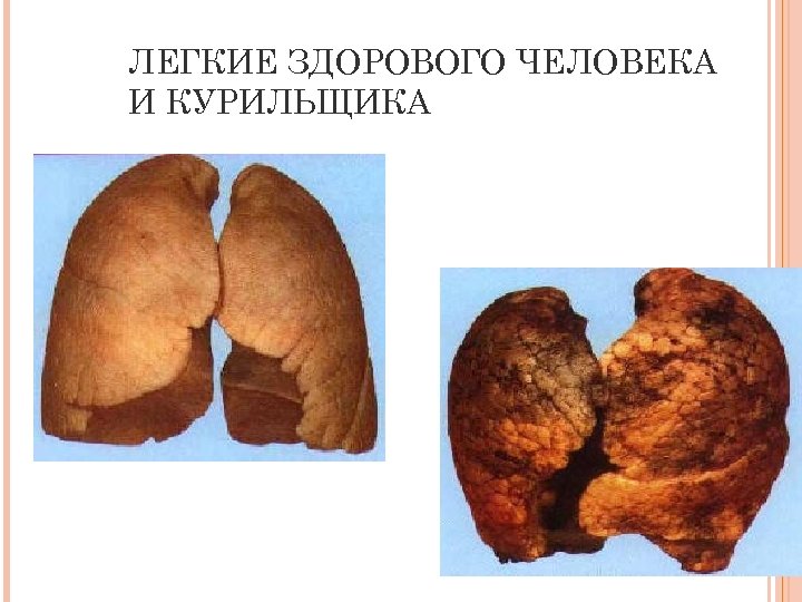 ЛЕГКИЕ ЗДОРОВОГО ЧЕЛОВЕКА И КУРИЛЬЩИКА 