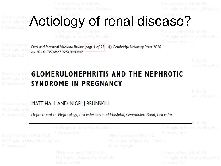 Slides courtesy of Matt Hall Slides courtesy of Matt Hall Nottingham University Hospitals Nottingham