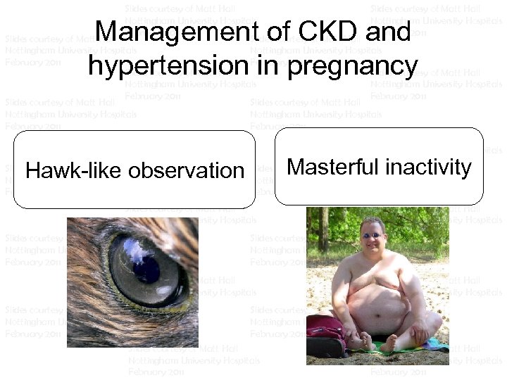 Slides courtesy of Matt Hall Slides courtesy of Matt Hall Nottingham University Hospitals Nottingham