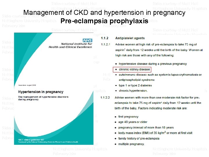 Slides courtesy of Matt Hall Slides courtesy of Matt Hall Nottingham University Hospitals Nottingham