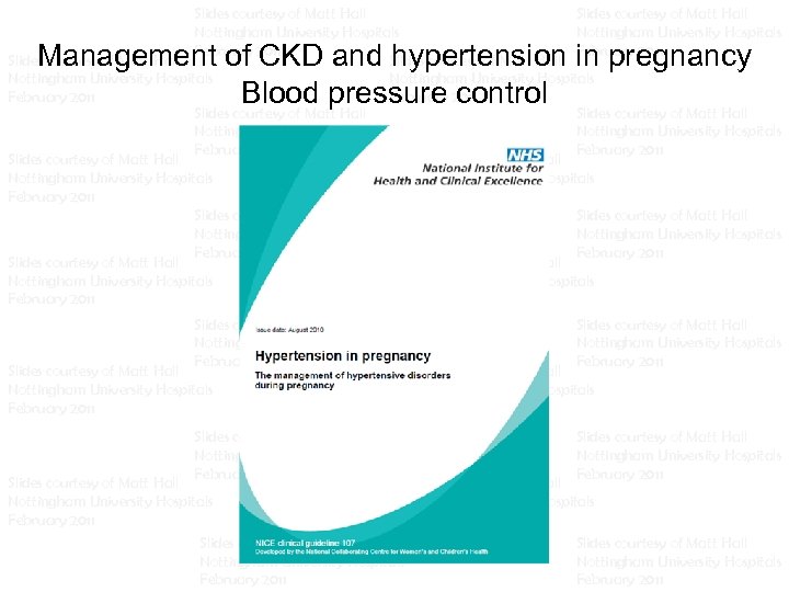 Slides courtesy of Matt Hall Slides courtesy of Matt Hall Nottingham University Hospitals Nottingham