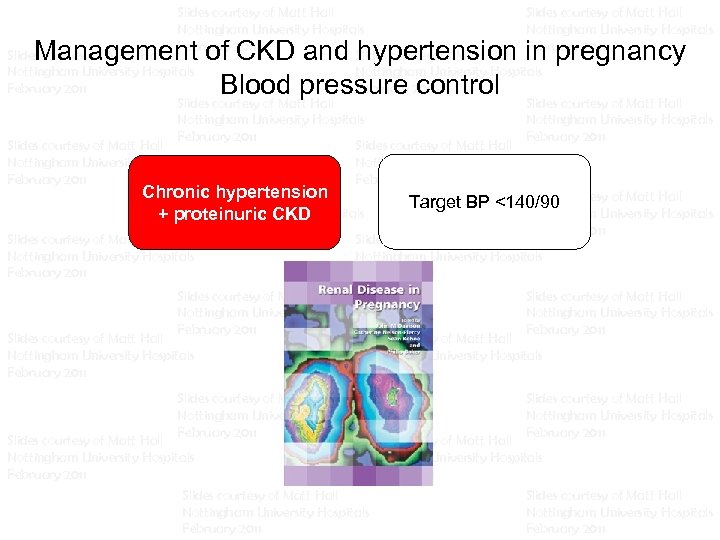 Slides courtesy of Matt Hall Slides courtesy of Matt Hall Nottingham University Hospitals Nottingham
