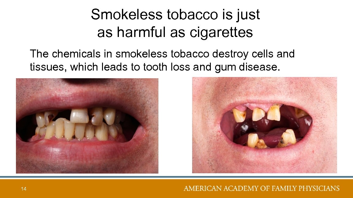 Smokeless tobacco is just as harmful as cigarettes The chemicals in smokeless tobacco destroy