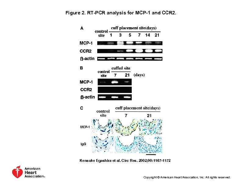 Figure 2. RT-PCR analysis for MCP-1 and CCR 2. Kensuke Egashira et al. Circ