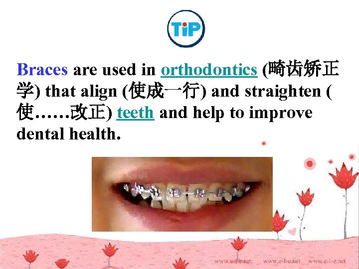 Braces are used in orthodontics (畸齿矫正 学) that align (使成一行) and straighten ( 使……改正)