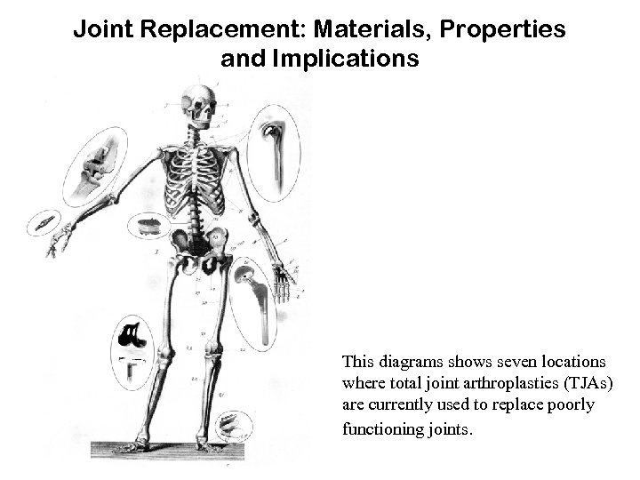 Joint Replacement: Materials, Properties and Implications This diagrams shows seven locations where total joint