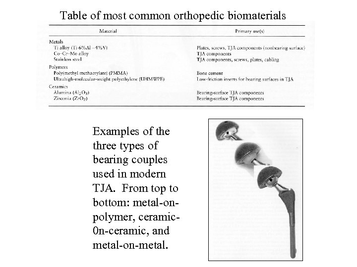 Table of most common orthopedic biomaterials Examples of the three types of bearing couples