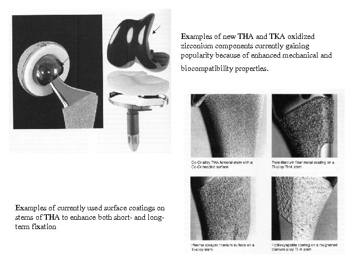 Examples of new THA and TKA oxidized zirconium components currently gaining popularity because of