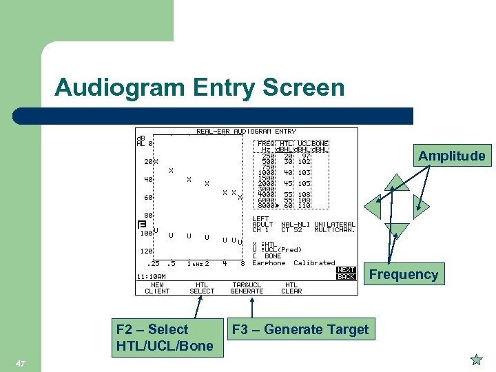 Audiogram Entry Screen Amplitude Frequency F 2 – Select HTL/UCL/Bone 47 F 3 –