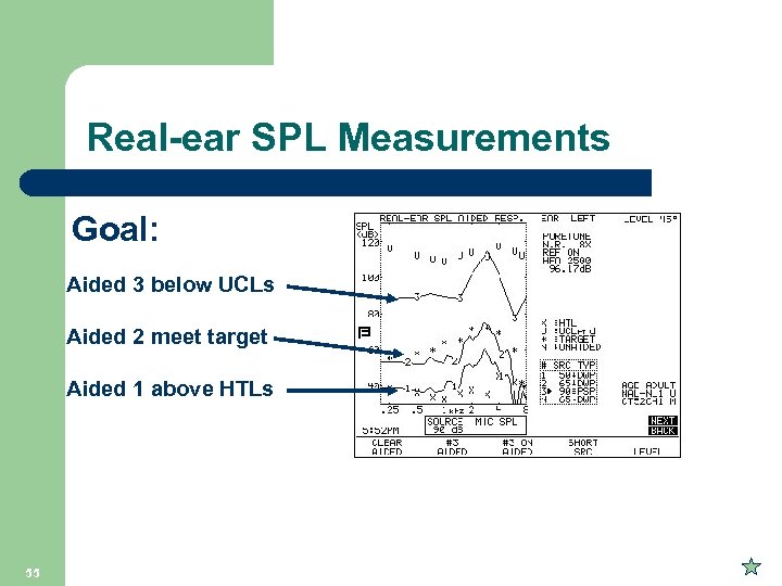 Real-ear SPL Measurements Goal: Aided 3 below UCLs Aided 2 meet target Aided 1