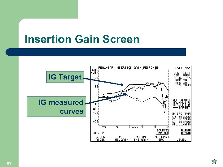 Insertion Gain Screen IG Target IG measured curves 69 
