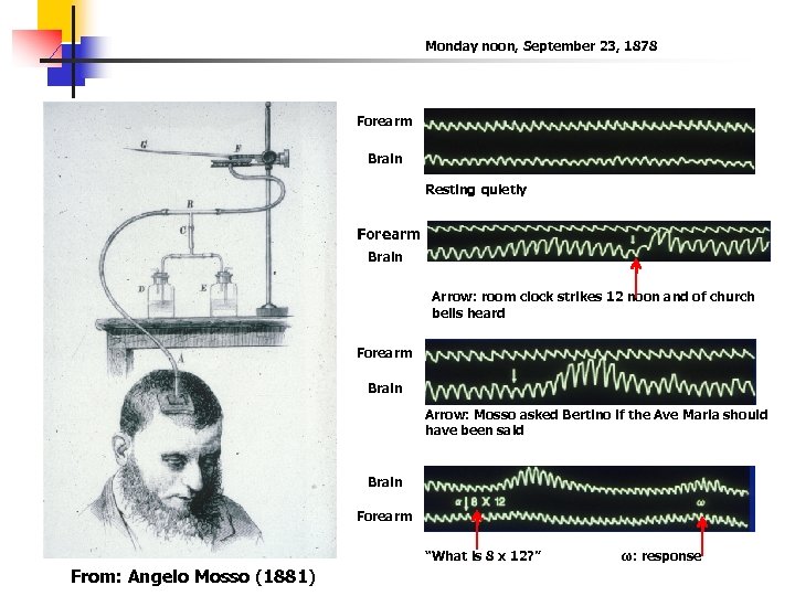 Monday noon, September 23, 1878 Forearm Brain Resting quietly Forearm Brain Arrow: room clock