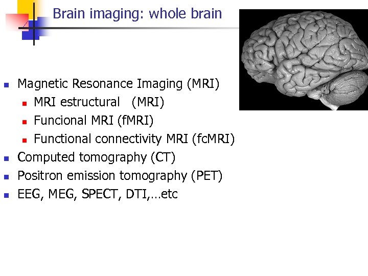 Brain imaging: whole brain n n Magnetic Resonance Imaging (MRI) n MRI estructural (MRI)