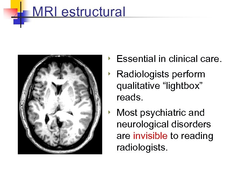 MRI estructural ‣ Essential in clinical care. ‣ Radiologists perform qualitative “lightbox” reads. ‣