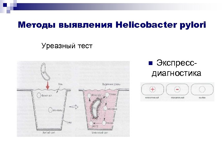 Методы выявления Helicobacter pylori Уреазный тест Экспрессдиагностика n 