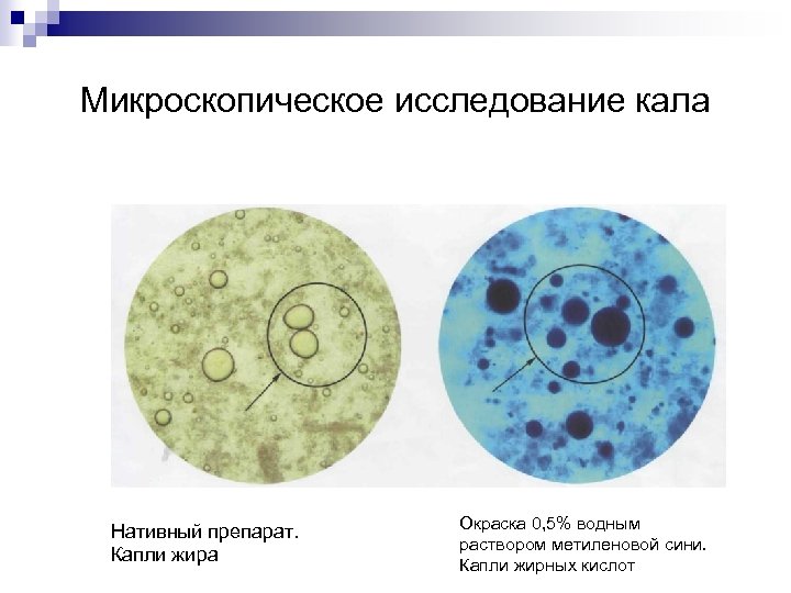 Исследование микроскопической картины кала