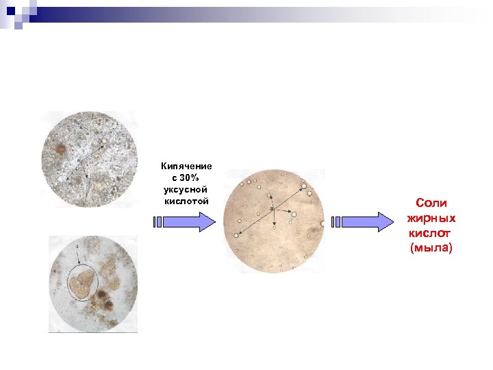 Жирные кислоты в кале фото под микроскопом