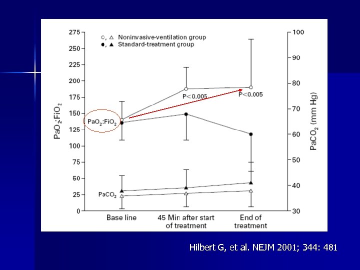 Hilbert G, et al. NEJM 2001; 344: 481 