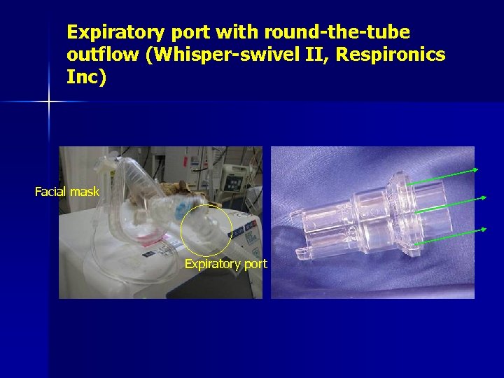 Expiratory port with round-the-tube outflow (Whisper-swivel II, Respironics Inc) Facial mask Expiratory port 