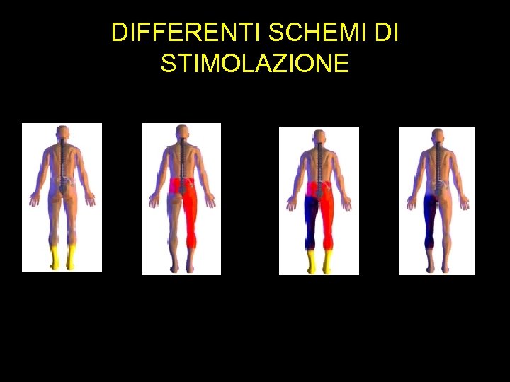 DIFFERENTI SCHEMI DI STIMOLAZIONE 