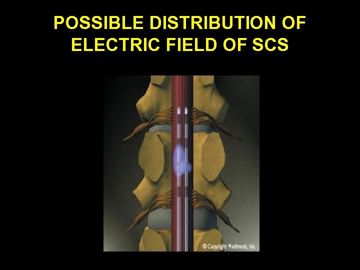 POSSIBLE DISTRIBUTION OF ELECTRIC FIELD OF SCS 