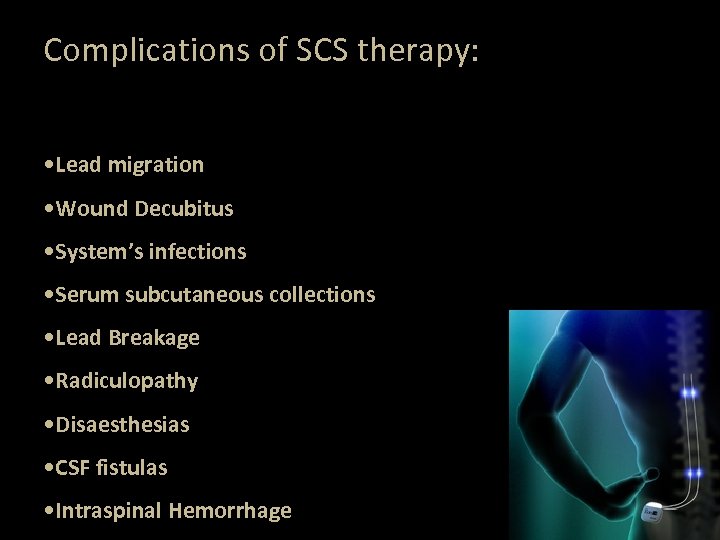 Complications of SCS therapy: • Lead migration • Wound Decubitus • System’s infections •