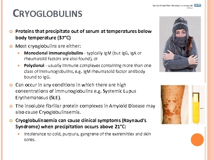 CRYOGLOBULINS Proteins that precipitate out of serum at temperatures below body temperature (37°C) Most