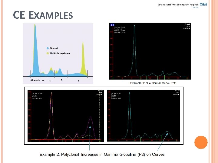 CE EXAMPLES 