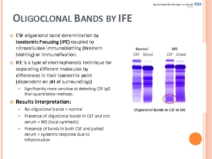 OLIGOCLONAL BANDS BY IFE CSF oligoclonal band determination by Isoelectric Focusing (IFE) coupled to