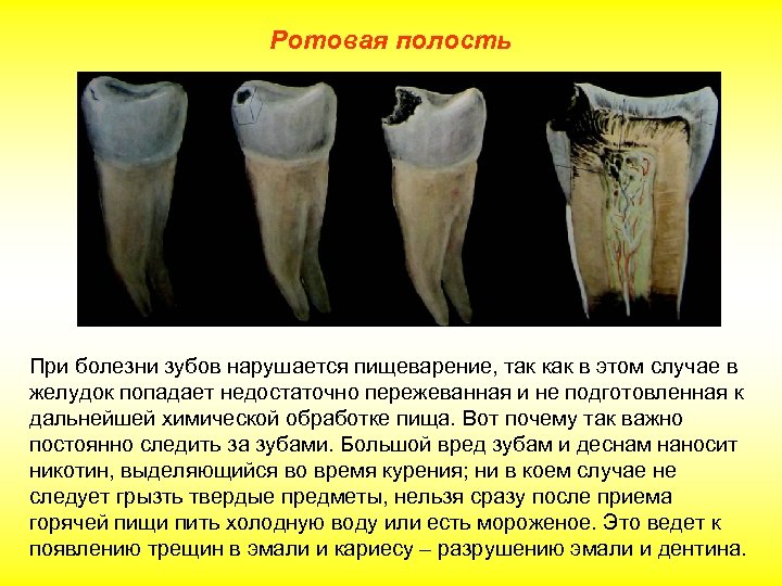 Ротовая полость При болезни зубов нарушается пищеварение, так как в этом случае в желудок