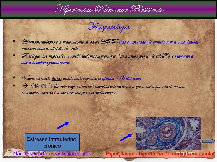 Hipertensão Pulmonar Persistente Fisiopatologia • A vasoconstricção é a mais simples causa de HPP: