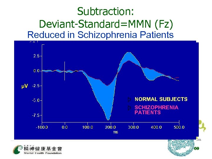 Subtraction: Deviant-Standard=MMN (Fz) Reduced in Schizophrenia Patients μV μV þ NORMAL SUBJECTS þ SCHIZOPHRENIA