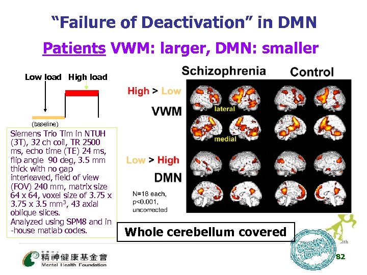 “Failure of Deactivation” in DMN Patients VWM: larger, DMN: smaller Low load High load