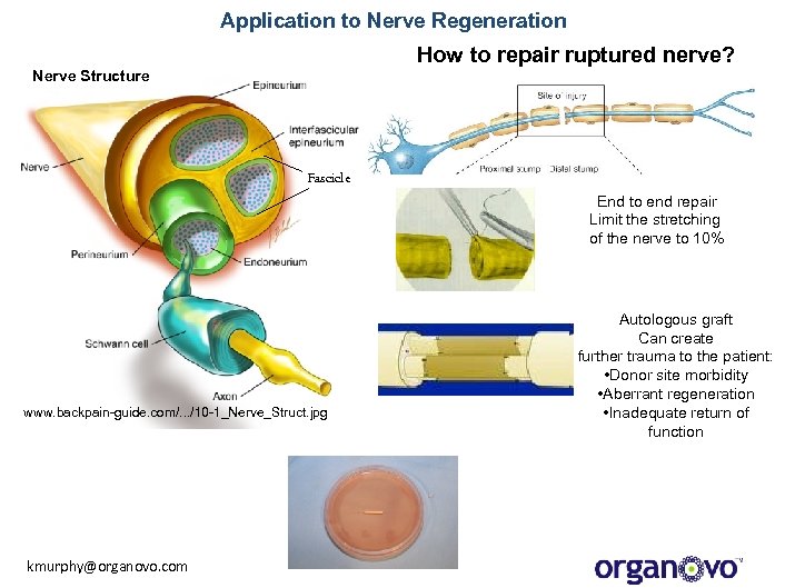Application to Nerve Regeneration How to repair ruptured nerve? Nerve Structure Fascicle End to