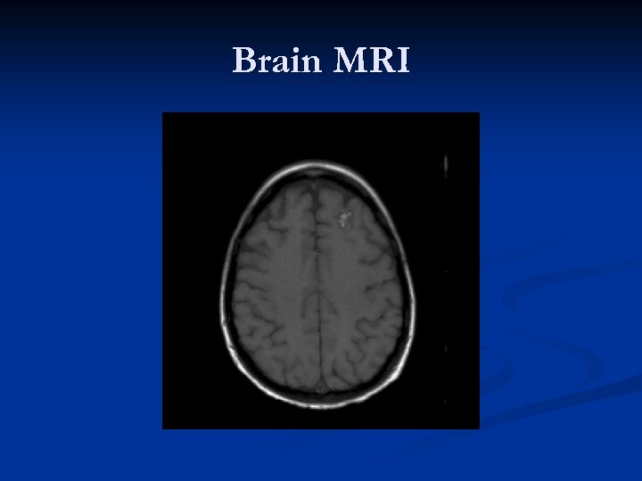 Brain MRI 