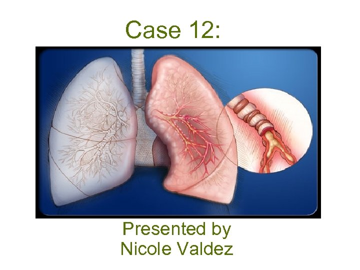 Case 12: Presented by Nicole Valdez 