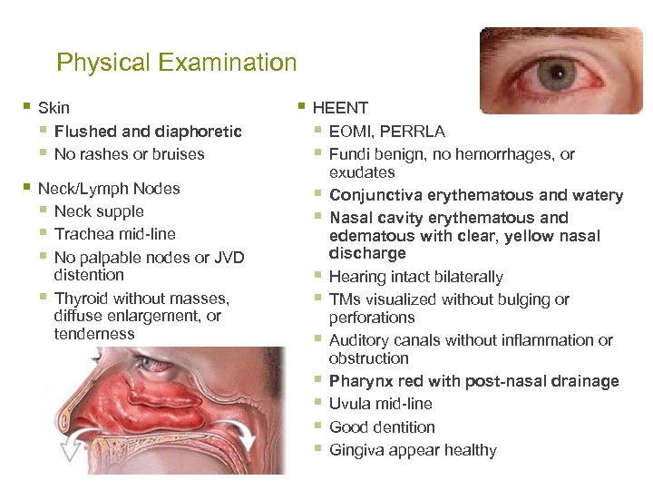 Physical Examination § Skin § Flushed and diaphoretic § No rashes or bruises §