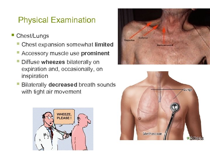 Physical Examination § Chest/Lungs § Chest expansion somewhat limited § Accessory muscle use prominent