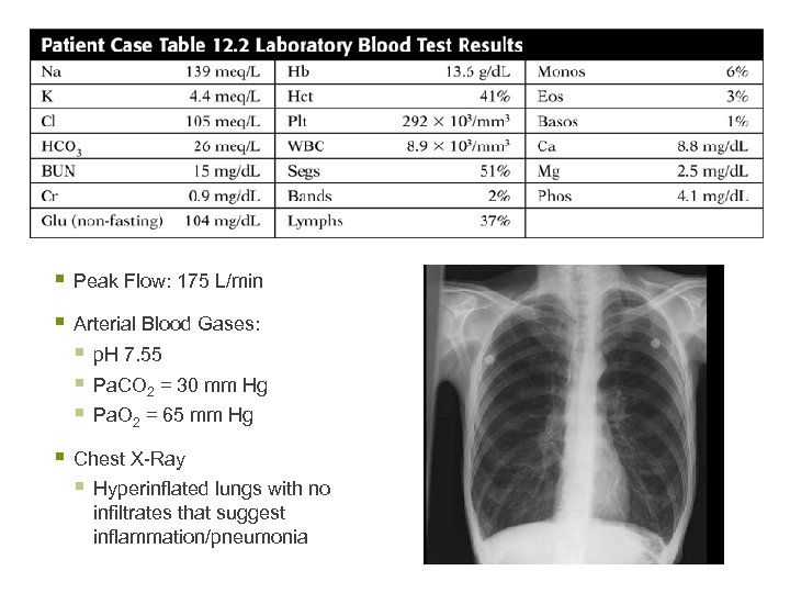 § Peak Flow: 175 L/min § Arterial Blood Gases: § p. H 7. 55