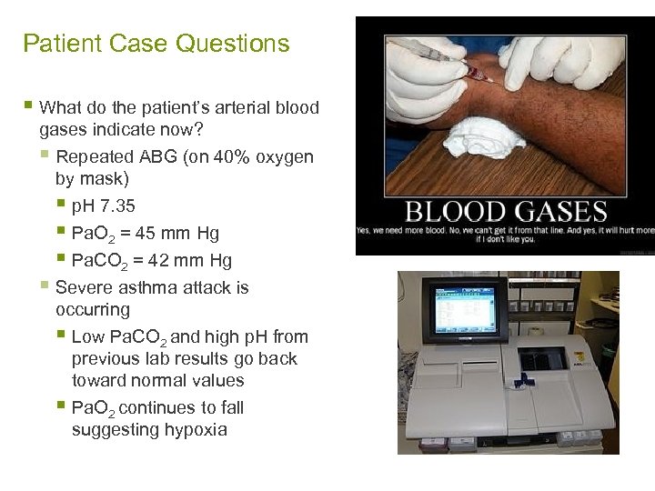 Patient Case Questions § What do the patient’s arterial blood gases indicate now? §